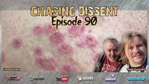 Monkey Pox - Be Afraid? - Chasing Dissent LIVE - Episode 90