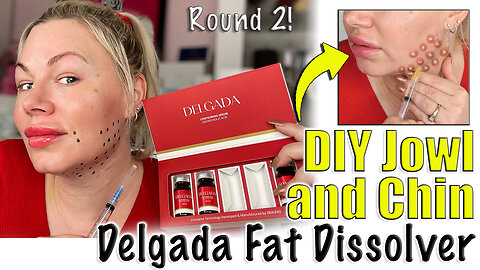 DIY Jowl and Chin Fat Dissolving with Delgada, Maypharm.net | Code Jessica10 saves you money!