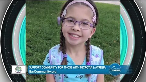 Support for Microtia & Atresia // Ear Community