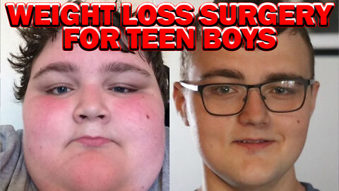 The Rise of Weight Loss Surgery For Teenagers | Surgery VS Lifestyle