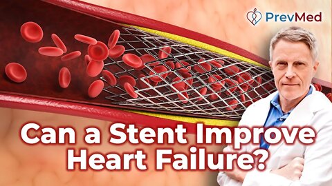 Can a stent improve heart failure caused by atrial fibrillation?