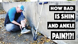 Pain Fails! Ankle Damage! How PAINFUL is hitting your shin?!?