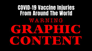 COVID-19 Vaccine Injuries From Around The World (Graphic Content)