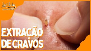 Só Relaxe Extração de Cravos - Remove Cravos e Espinhas Asmr - Just Relax | Apenas Relaxe