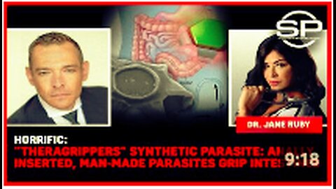 Horrific: "Theragrippers" Synthetic Parasite: Anally Inserted, Man-Made Parasites Grip Intestines