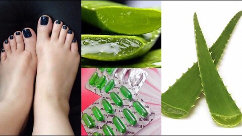 Make Your Hands & Feet Beautiful And Soft With Aloe Vera!! DIY Remedies. | [EP-20]