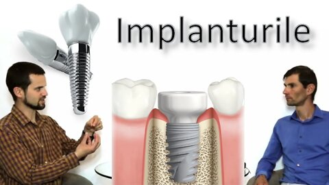 12d - Implanturile dentare - Cand dantura devine cauză a bolii