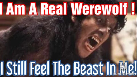 Boy claims he is a werewolf