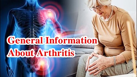 General Information About Arthritis