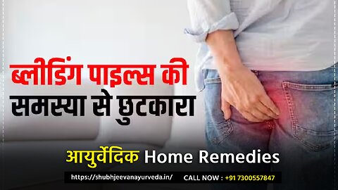 Piles / बवासीर का घरेलु उपचार | Best 5 Home Remedies For Piles Problem Solution Without Surgery