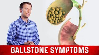 Gallstone Symptoms and Causes Explained – Dr.Berg on Gallbladder Stone Removal