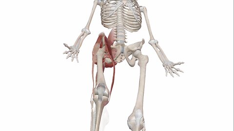 Total hip replacement part 2 hip - human animated anatomy