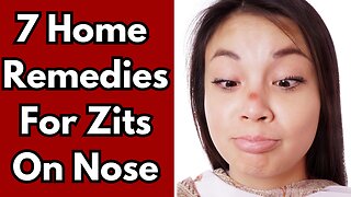 7 Home Remedies For Zits On Nose