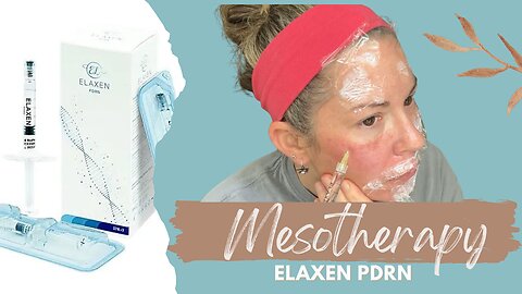 Mesotherapy with Elaxen PDRN | Meso FAIL
