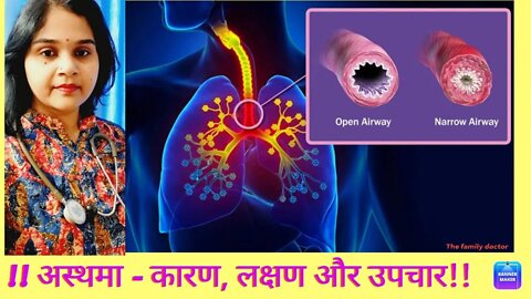 Asthma - Symptoms and causes - Prevention and homeopathic Treatment #asthma ma #drminakshisingh