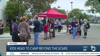 Dozens of kids head to Camp Beyond the Scars