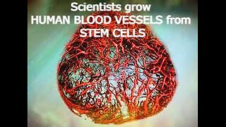 Scientists grow human blood vessels from stem cells in a dish