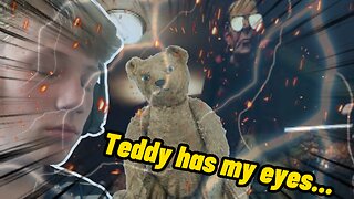 See What Teddy Has Going on with His Eyes! You Won't Believe It...