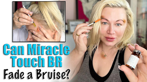 How to Fade a Bruise | Code Jessica10 saves you $$$