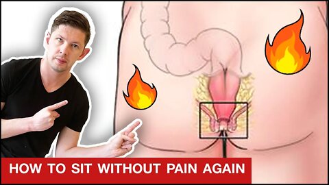 How To Stop Burning Rectal Pain & Burning Anus Pain OVERNIGHT