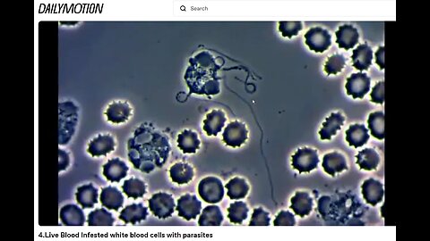 Is Cancer Caused by Microparasites in Your Cells and Low Frequency?