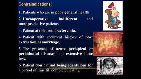 Prosthodontics L12 (Immediate Denture)