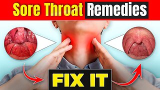 Sore throat remedies at home / How to treat sore throat at home