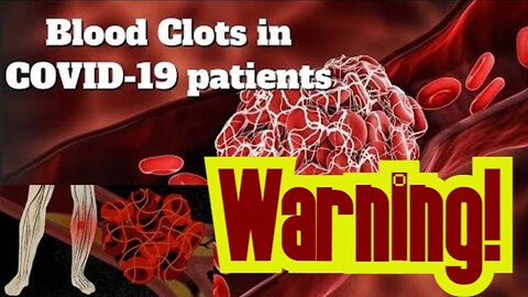 COVID-19 BLOOD 🩸 CLOTS