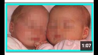 TWIN BABIES killed by VAXX poison: "Simultaneous Sudden Infant Death" case report