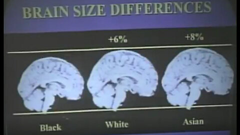 Prof. Philippe Rushton: Race Differences In Brain Size "Latest Research on Race" - Excerpt