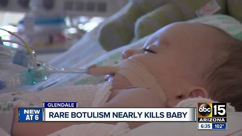 Rare botulism case nearly kills Valley baby