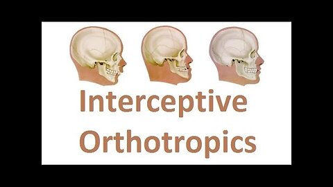 Correcting the Growth of Upper Jaw with Interceptive Orthotropics by Prof John Mew