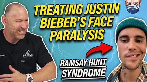 Treating Justin Bieber's Ramsay Face Paralysis