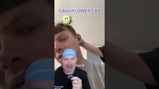 Fixing a Fighter’s Cauliflower Ear 👂 #shorts