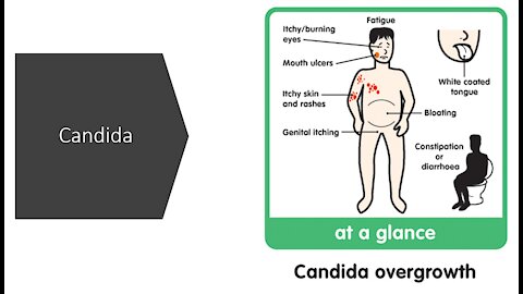 Candida overgrowth - Herbs, Supplements & Diet Plan