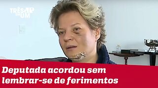 Joice Hasselmann apresenta lesões e diz ter sido vítima de atentado