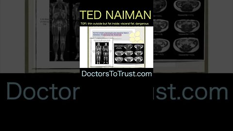 Ted Naiman B