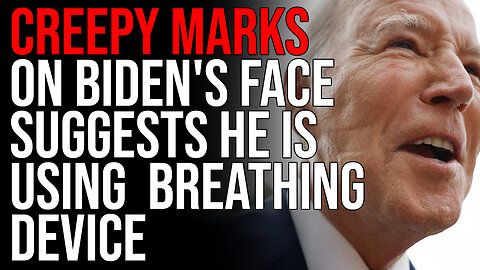 Creepy Marks On Biden's Face Suggests He Is Using Some Kind Of Breathing Device, Health Fears WORSEN