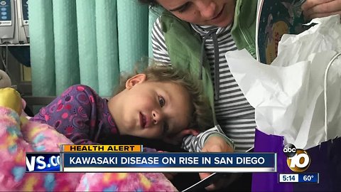 Kawasaki disease cases on rise in San Diego