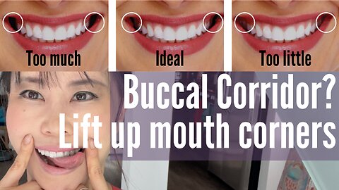 Buccal Corridors | How to smile with lifted mouth corners