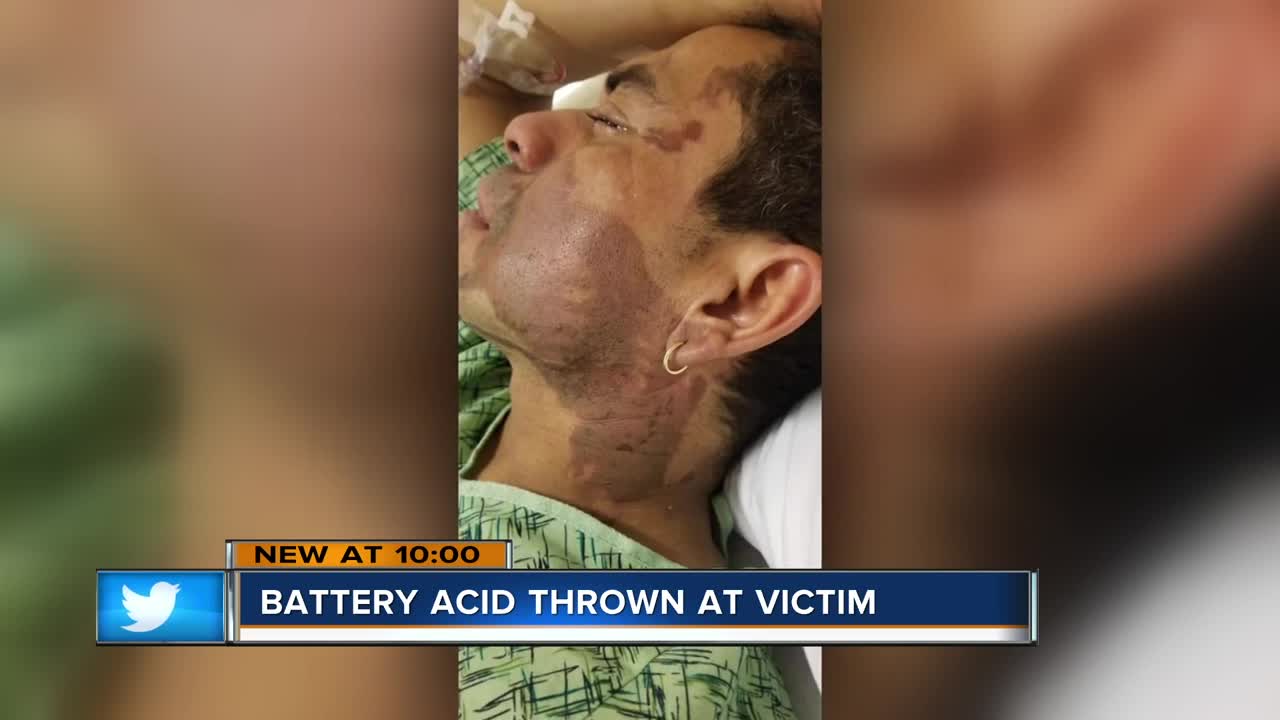 A Milwaukee man is recovering after being attacked with battery acid.