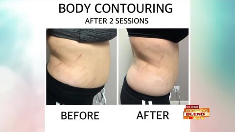 Body Contouring That Works