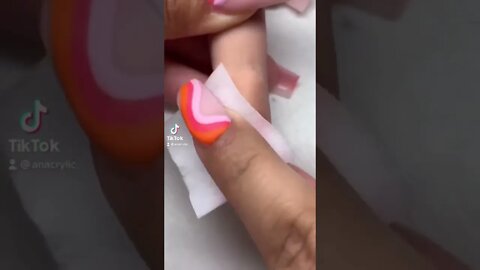 stuck something in finger