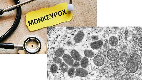 What do we know about the Monkeypox virus? Making this video before misinformation spreads.