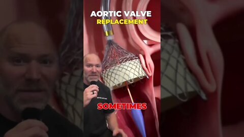 Heart Valve Replacement Surgery 🫀 #shorts