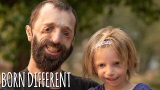 Father And Daughter Battle Rare Facial Condition | BORN DIFFERENT