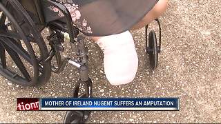 Mother of girl who lost both legs in lawn mowing accident undergoes own amputation