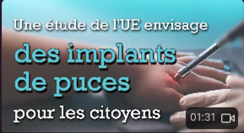 Une étude de l'UE envisage des implants de puces pour les citoyens