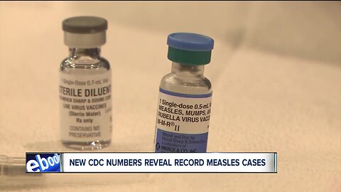 Measles outbreak is largest in US in 25 years, CDC says