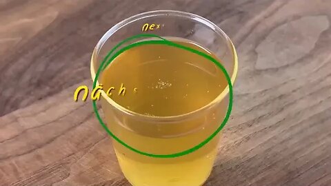 Clean Your Lungs and Stop Coughing in Three Days! Prescription for bronchitis. Recipes